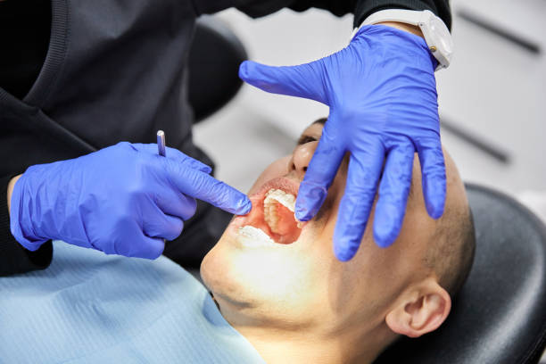 Best Emergency Wisdom Tooth Extraction in Paramount, CA